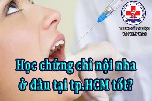 Học chứng chỉ nội nha ở đâu tại tpHCM tốt? Học chứng chỉ nội nha ở đâu tại tpHCM tốt?