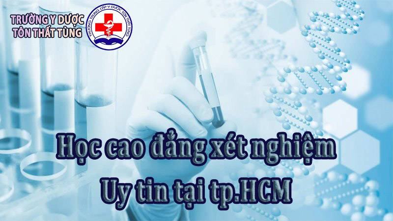 Học cao đẳng xét nghiệm uy tín tại tpHCM. Học cao đẳng xét nghiệm uy tín tại tpHCM.