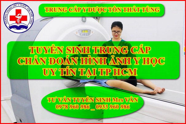 Tuyển Sinh Trung Cấp Chẩn Đoán Hình Ảnh Y học tại TP. HCM Tuyển Sinh Trung Cấp Chẩn Đoán Hình Ảnh Y học