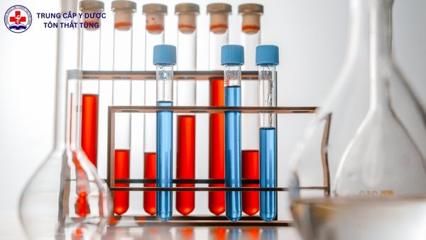 Kỹ thuật Xét nghiệm Y học điểm chuẩn bao nhiêu? Hướng chọn lộ trình học phù hợp năng lực Điểm chuẩn ngành Kỹ thuật Xét nghiệm Y