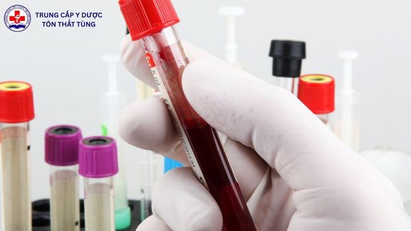 Sợ máu có nên học Điều dưỡng