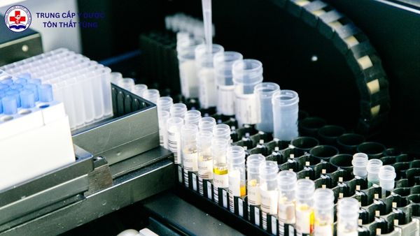 Có nên học Xét nghiệm Y học không? Cơ hội và thách thức có nên học xét nghiệm y học