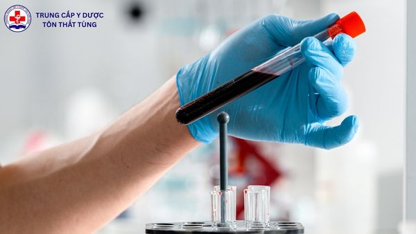 Kỹ thuật Xét nghiệm Y học thi khối nào? Cách chọn tổ hợp phù hợp để dễ trúng tuyển kỹ thuật xét nghiệm y học thi khối nào