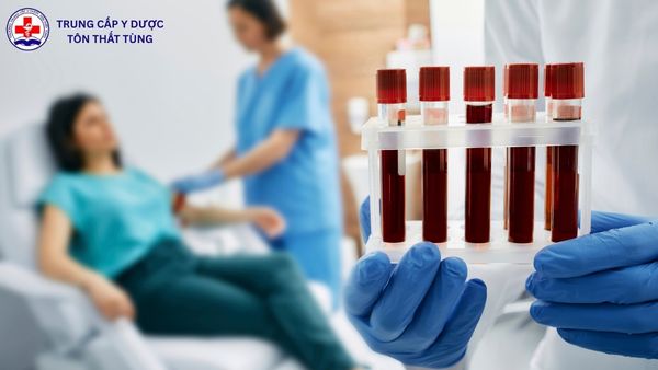 Mức lương của ngành Xét nghiệm Y học hiện nay bao nhiêu? mức lương của ngành xét nghiệm y học