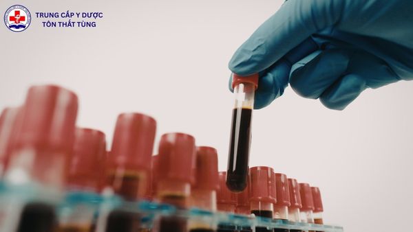 Mức lương của ngành Xét nghiệm Y học hiện nay bao nhiêu? mức lương của ngành xét nghiệm y học