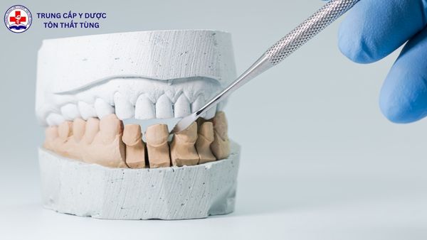 Kỹ thuật phục hình răng điểm chuẩn bao nhiêu? Cập nhật mới 2026 kỹ thuật phục hình răng điểm chuẩn