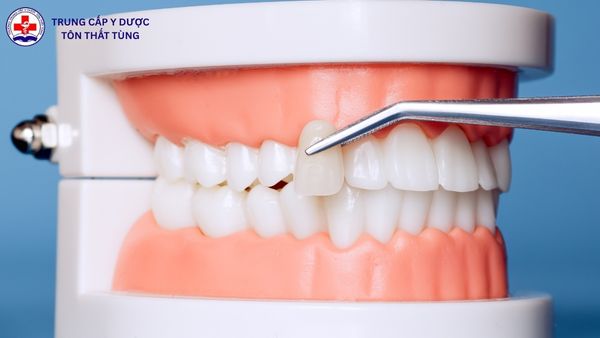 Kỹ thuật phục hình răng điểm chuẩn bao nhiêu? Cập nhật mới 2026 kỹ thuật phục hình răng điểm chuẩn