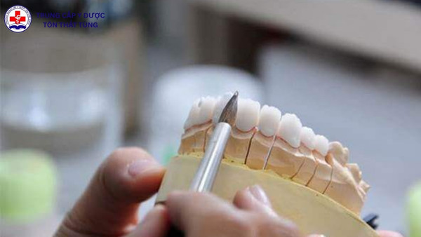 Lương kỹ thuật viên phục hình răng hiện nay là bao nhiêu? lương kỹ thuật viên phục hình răng