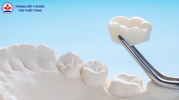 Trung cấp kỹ thuật phục hình răng là gì? Học gì, làm gì, cơ hội ra sao? trung cấp kỹ thuật phục hình răng