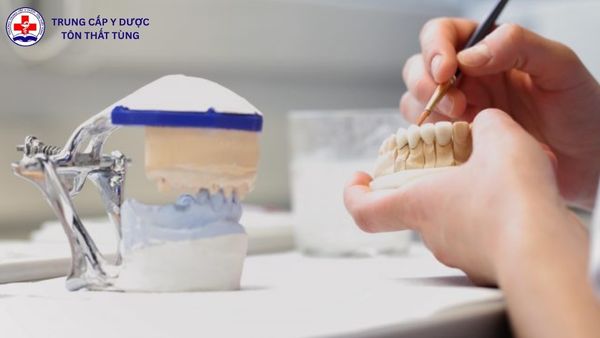 trung cấp kỹ thuật phục hình răng