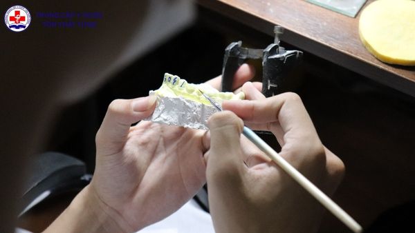 Trung cấp kỹ thuật phục hình răng là gì? Học gì, làm gì, cơ hội ra sao? trung cấp kỹ thuật phục hình răng